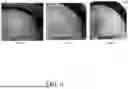 Fig. 07 - TOPICAL FORMULATIONS COMPRISING TOFACITINIB