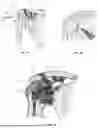 Fig. 02 - Guiding Musculoskeletal Procedures