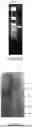 Fig. 02 - COMPOSITIONS COMPRISING RECOMBINANT STRAINS OF MYCOBACTERIUM, USES THEREOF AND METHODS FOR THE PREVENTION AND/OR TREATMENT OF CANCER