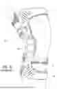 Fig. 02 - MULTI-COMPONENT FRAME FOR USE IN AN ORTHOPEDIC DEVICE