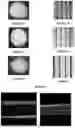 Fig. 02 - ARTIFICIAL CONSTRUCTS FOR USE IN OPHTHALMOLOGY, METHODS FOR OBTAINING THE SAME, AND THEIR USE