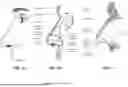 Fig. 11 - PATIENT INTERFACE WITH A SEAL-FORMING STRUCTURE HAVING VARYING THICKNESS