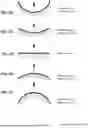 Fig. 15 - PATIENT INTERFACE WITH A SEAL-FORMING STRUCTURE HAVING VARYING THICKNESS