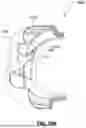 Fig. 42 - PATIENT INTERFACE WITH A SEAL-FORMING STRUCTURE HAVING VARYING THICKNESS