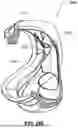 Fig. 45 - PATIENT INTERFACE WITH A SEAL-FORMING STRUCTURE HAVING VARYING THICKNESS