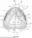 Fig. 48 - PATIENT INTERFACE WITH A SEAL-FORMING STRUCTURE HAVING VARYING THICKNESS