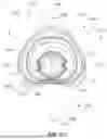 Fig. 56 - PATIENT INTERFACE WITH A SEAL-FORMING STRUCTURE HAVING VARYING THICKNESS