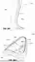 Fig. 63 - PATIENT INTERFACE WITH A SEAL-FORMING STRUCTURE HAVING VARYING THICKNESS