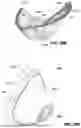 Fig. 66 - PATIENT INTERFACE WITH A SEAL-FORMING STRUCTURE HAVING VARYING THICKNESS