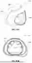 Fig. 71 - PATIENT INTERFACE WITH A SEAL-FORMING STRUCTURE HAVING VARYING THICKNESS