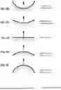 Fig. 15 - CONDUIT HEADGEAR CONNECTOR FOR PATIENT INTERFACE