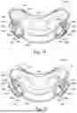 Fig. 33 - CONDUIT HEADGEAR CONNECTOR FOR PATIENT INTERFACE