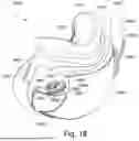 Fig. 34 - CONDUIT HEADGEAR CONNECTOR FOR PATIENT INTERFACE