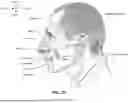 Fig. 09 - GAS WASHOUT VENT FOR PATIENT INTERFACE