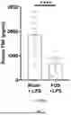 Fig. 02 - STIMULATION OF THE CELIAC-SUPERIOR MESENTERIC GANGLION COMPLEX FOR TREATING INFLAMMATION
