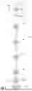 Fig. 09 - METHODS FOR MIXING A FLUID WITH FOLDABLE IMPELLERS