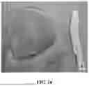 Fig. 17 - METHODS FOR MANUFACTURING AND DISTRIBUTING SEMI-RIGID ACOUSTIC COUPLING ARTICLES AND PACKAGING FOR ULTRASOUND IMAGING