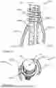 Fig. 08 - SPRING-BASED SUPPORT DEVICE FOR ANCHORING AND/OR CENTRALIZING A BOLT OR PIPE IN A BOREHOLE