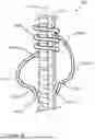 Fig. 09 - SPRING-BASED SUPPORT DEVICE FOR ANCHORING AND/OR CENTRALIZING A BOLT OR PIPE IN A BOREHOLE