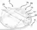 Fig. 01 - VALVE AND METHOD FOR MANUFACTURING A CLOSURE MEMBER