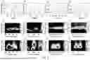 Fig. 08 - FIRST-DIMENSION-GUIDED DIFFERENTIAL RESCALING OF CONTOUR PLOT IN COMPREHENSIVE TWO-DIMENSIONAL GAS CHROMATOGRAPHY