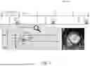 Fig. 03 - AUTOMATIC INVERSION TIME SELECTION FOR FLOW-INDEPENDENT DARK BLOOD DELAYED ENHANCEMENT