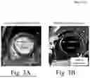 Fig. 04 - AUTOMATIC INVERSION TIME SELECTION FOR FLOW-INDEPENDENT DARK BLOOD DELAYED ENHANCEMENT