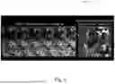 Fig. 07 - AUTOMATIC INVERSION TIME SELECTION FOR FLOW-INDEPENDENT DARK BLOOD DELAYED ENHANCEMENT