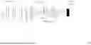 Fig. 08 - INSTANT POLARIZED LIGHT MICROSCOPE