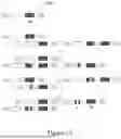 Fig. 20 - METHOD AND APPARATUS FOR LIMITING GROWTH OF EYE LENGTH