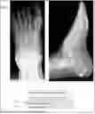 Fig. 01 - SYSTEM AND METHOD FOR CLASSIFYING TYPE OF A FRACTURE ON MUSCULOSKELETAL X-RAY IMAGE