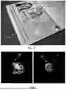 Fig. 02 - METHOD AND SYSTEM FOR THE AUTHENTICATION OF HOLOGRAM PROTECTED IDENTITY DOCUMENTS