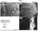 Fig. 05 - AMORPHOUS PROTEIN EXTRUDATES