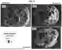 Fig. 06 - AMORPHOUS PROTEIN EXTRUDATES
