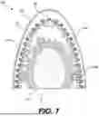 Fig. 10 - ARTICLE OF FOOTWEAR HAVING AN UPPER