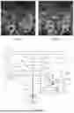 Fig. 04 - IMAGING APPARATUS AND METHOD FOR IN VIVO FULL-FIELD INTERFERENCE IMAGING OF A SAMPLE