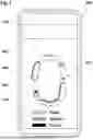 Fig. 08 - ORAL SCANNER SYSTEM