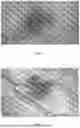 Fig. 07 - SKIN EXAMINATION DEVICE