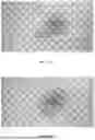 Fig. 11 - SKIN EXAMINATION DEVICE