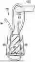 Fig. 01 - KNOTLESS ALL SUTURE TISSUE REPAIR