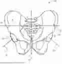 Fig. 01 - SYSTEM AND METHOD FOR SURGICAL PLANNING