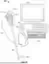 Fig. 02 - DEVICE AND METHOD FOR TRACKING THE POSITION OF AN ENDOSCOPE WITHIN A PATIENT'S BODY