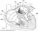 Fig. 01 - TRANSCATHETER VALVE RECAPTURE DEVICES AND METHODS