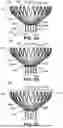 Fig. 04 - TRANSCATHETER VALVE RECAPTURE DEVICES AND METHODS