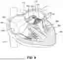 Fig. 10 - TRANSCATHETER VALVE RECAPTURE DEVICES AND METHODS