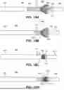 Fig. 15 - TRANSCATHETER VALVE RECAPTURE DEVICES AND METHODS