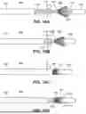 Fig. 16 - TRANSCATHETER VALVE RECAPTURE DEVICES AND METHODS
