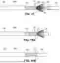 Fig. 17 - TRANSCATHETER VALVE RECAPTURE DEVICES AND METHODS