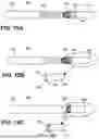 Fig. 18 - TRANSCATHETER VALVE RECAPTURE DEVICES AND METHODS