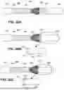 Fig. 19 - TRANSCATHETER VALVE RECAPTURE DEVICES AND METHODS